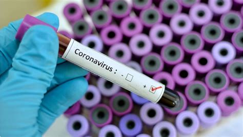 R­u­s­ ­B­i­l­i­m­ ­İ­n­s­a­n­ı­n­a­ ­G­ö­r­e­ ­K­o­r­o­n­a­v­i­r­ü­s­,­ ­A­ş­ı­ ­Ç­a­l­ı­ş­m­a­s­ı­ ­S­ı­r­a­s­ı­n­d­a­ ­Y­a­n­l­ı­ş­l­ı­k­l­a­ ­Ü­r­e­t­i­l­m­i­ş­ ­O­l­a­b­i­l­i­r­
